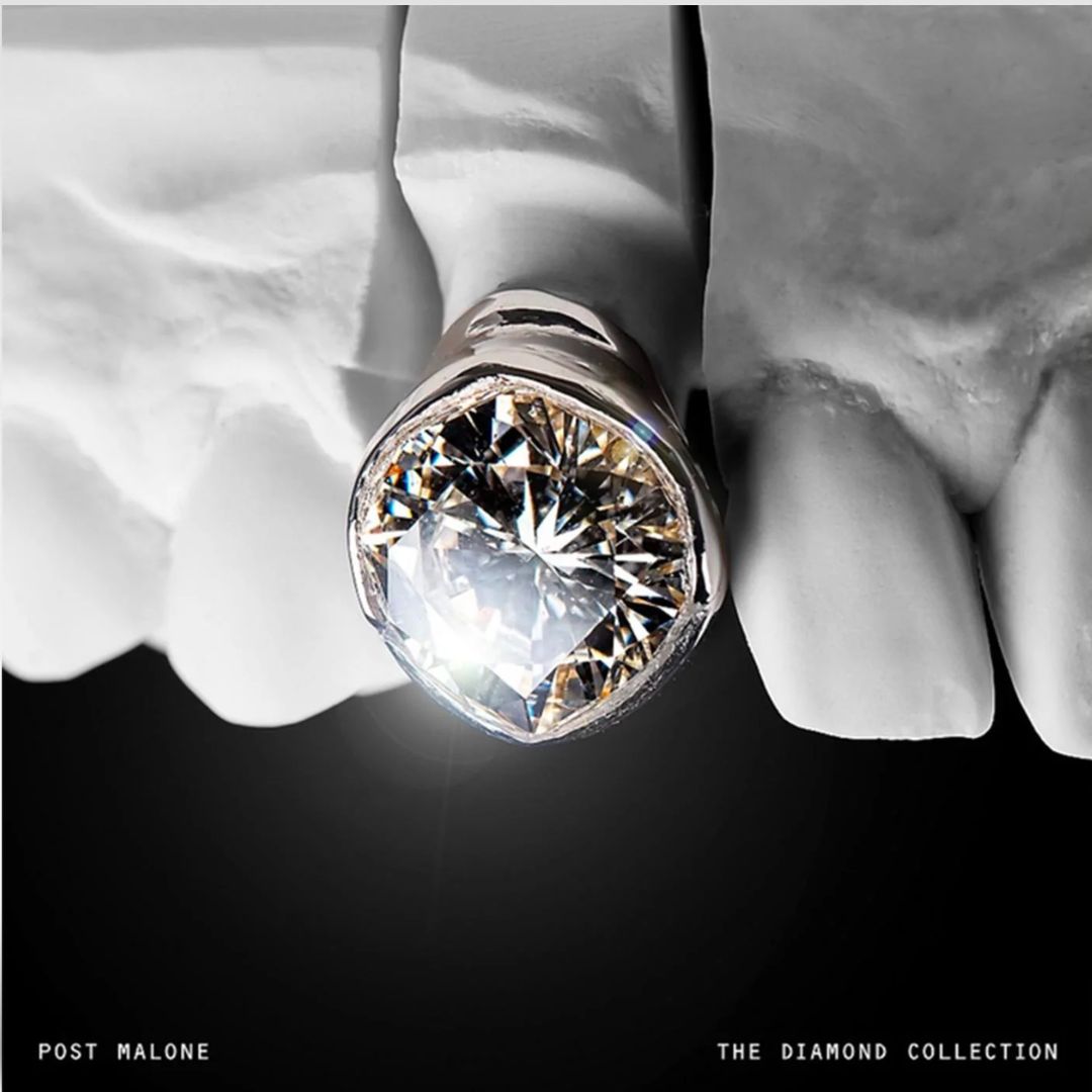 The Diamond Collection (2LP)